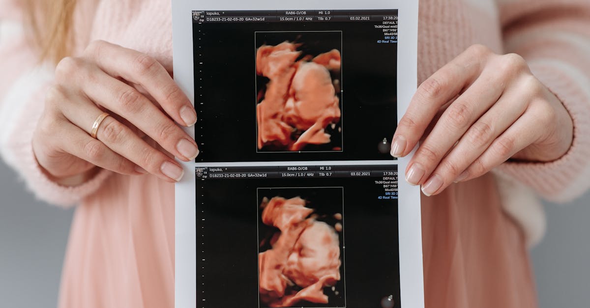 erfahren sie alles über die pränatalen vorsorge, die essenziell für die gesundheit von mutter und kind ist. unsere tipps und informationen helfen ihnen, eine gesunde schwangerschaft zu fördern und wichtige vorsorgeuntersuchungen nicht zu verpassen.